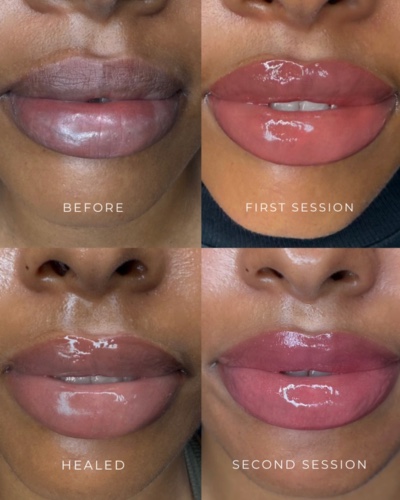 Lip blush shown before, after the first session, healed, and after the second session.